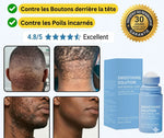 Load image into Gallery viewer, Sérum Hydratant Anti-Boutons de la Nuque &amp; Anti-Poils Incarnés
