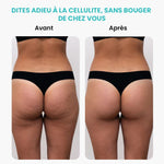Load image into Gallery viewer, Masseur Brûleur de Graisses Électrique Rotatif – Anti-Cellulite &amp; Minceur

